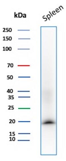 Stathmin 1 Antibody (STMN1/8437) - Azide and BSA Free Western Blot: Stathmin 1 Antibody (STMN1/8437) - Azide and BSA Free [NBP3-26961] -