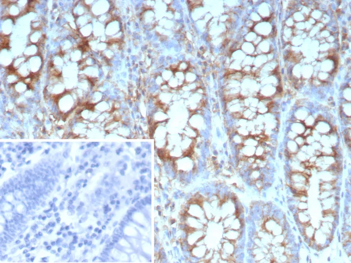 Stathmin 1 Antibody (STMN1/9227R)