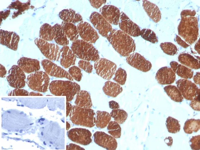 MYH7 Antibody (MYH7/727)