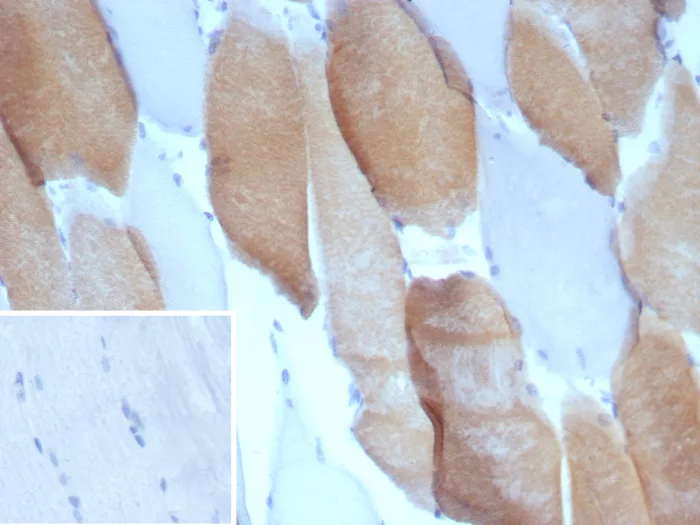 MYH7 Antibody (MYH7/9184)