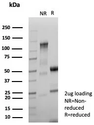 NM23-H2/NME2 Antibody (NME2/6433)