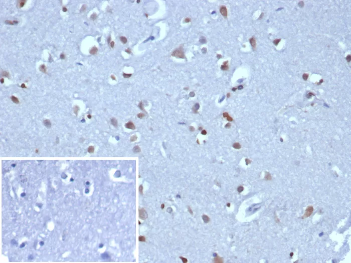 Neurogenin-3 Antibody (NGN3/1808)