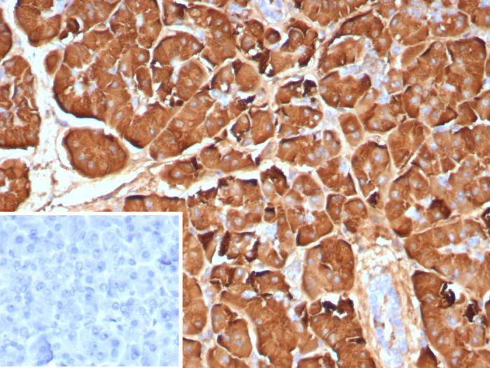 Pancreatic Lipase Antibody (PNLIP/9040)