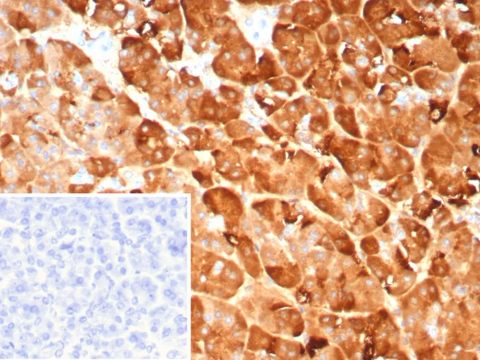 Pancreatic Lipase Antibody (PNLIP/9041)