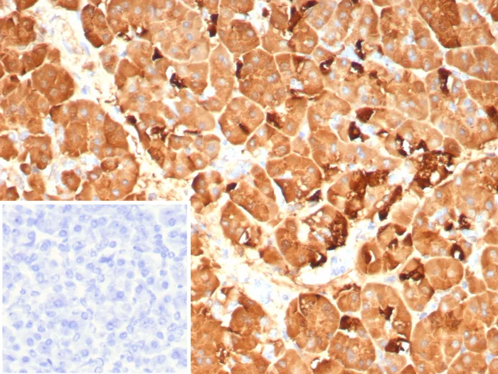 Pancreatic Lipase Antibody (PNLIP/9042)