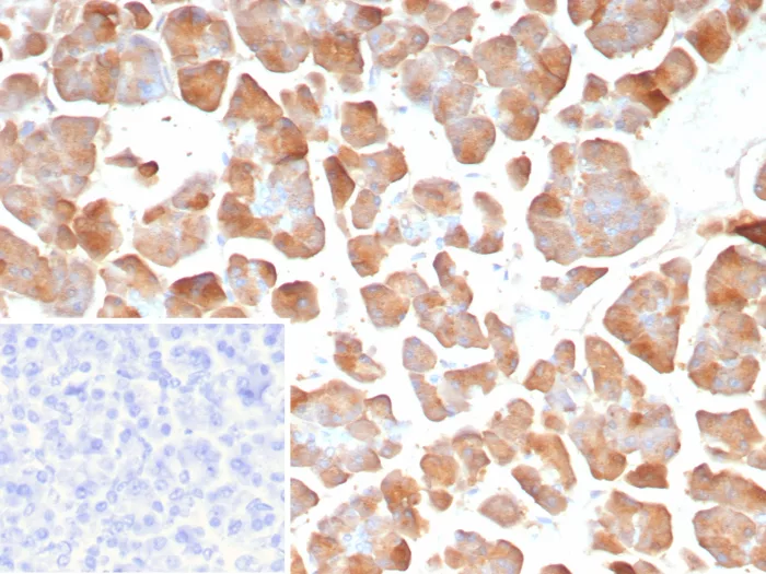 Pancreatic Lipase Antibody (PNLIP/8913)