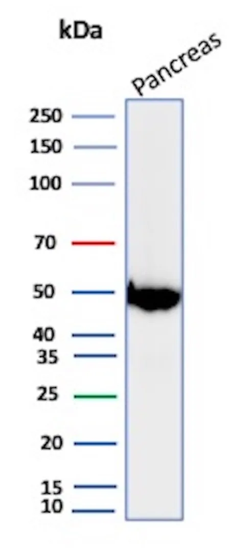 Pancreatic Lipase Antibody (PNLIP/8913)