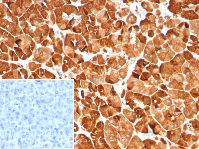 Pancreatic Lipase Antibody (PNLIP/9039)