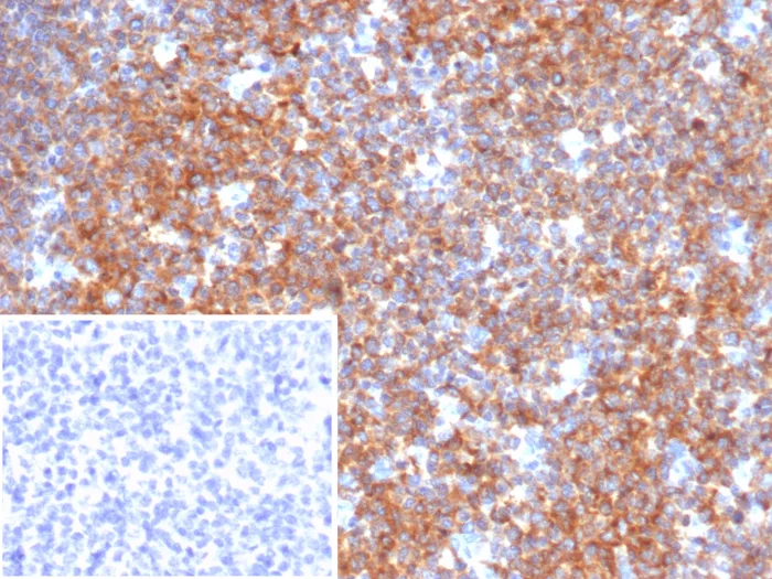 BCOR Antibody (BCOR/2372)