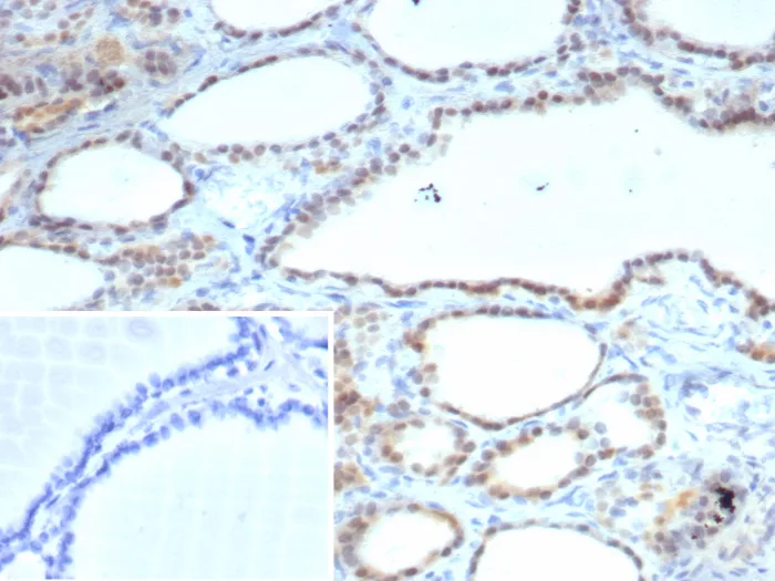 S100A13 Antibody (S100A13/7484)