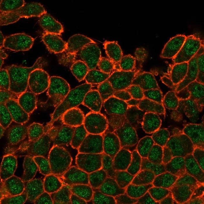 SATB1 Antibody (PCRP-SATB1-2C3)