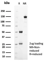 SDHA Antibody (SDHA/7493)