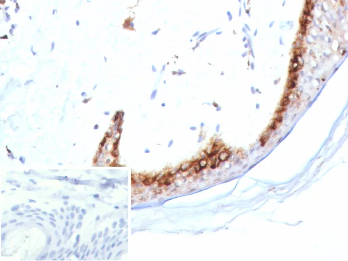 Kallikrein 4/Prostase/EMSP1 Antibody (KLK4/8942)