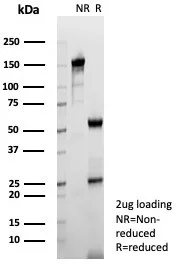 Tryptophan Hydroxylase 1/TPH-1 Antibody (TPH1/7661)