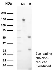 Tryptophan Hydroxylase 1/TPH-1 Antibody (TPH1/7662)