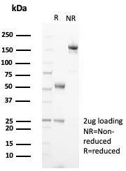 TRPC6 Antibody (TRPC6/7671)