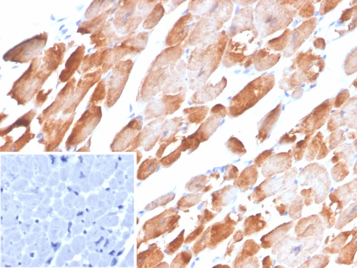 Tropomyosin-1 Antibody (TPM1/4510)