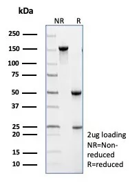 TRAF-1 Antibody (TRAF1/3299)