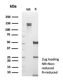 TRAF-1 Antibody (TRAF1/3365)