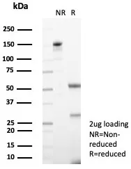 TRPC6 Antibody (TRPC6/7672)