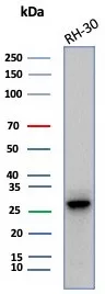 Carbonic Anhydrase III/CA3 Antibody (CA3/7883)