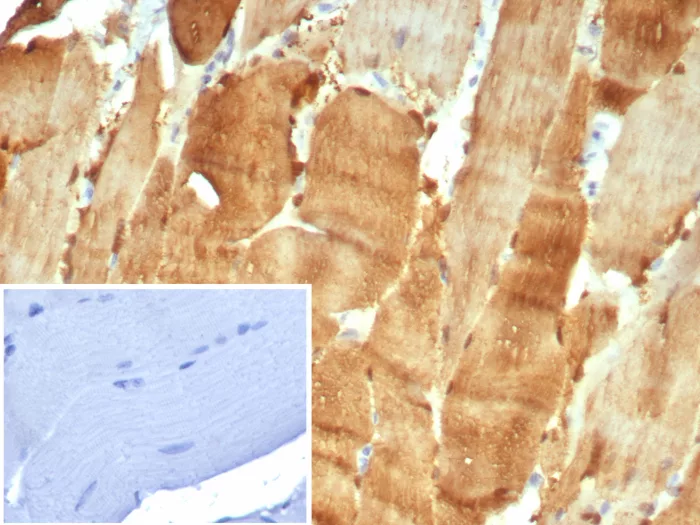 Carbonic Anhydrase III/CA3 Antibody (CA3/7884)