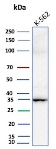 Carbonic Anhydrase VIII/CA8 Antibody (CA8/6814)