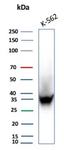 Carbonic Anhydrase VIII/CA8 Antibody (CA8/8605R)