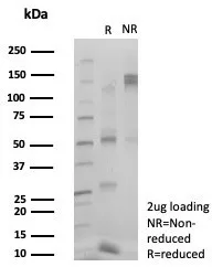 ZSCAN5 Antibody (PCRP-ZSCAN5A-2H4)