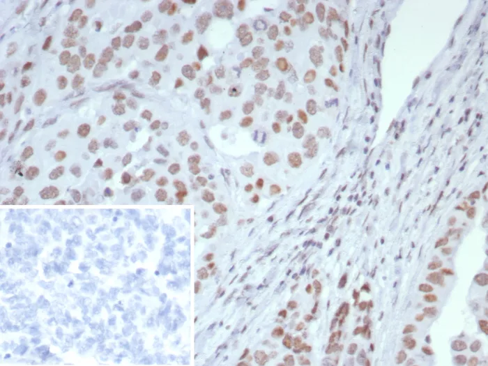 ARID1A Antibody (ARID1A/7735)