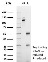 ABCB11 Antibody (BSEP/7534)