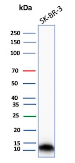 S100A16 Antibody (S100A16/7412)