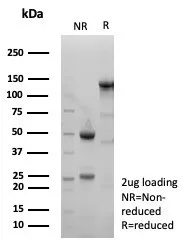 xCT Antibody (SLC7A11/9136R)