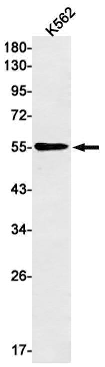 Melanoma antigen family C2 Antibody (SR2353)