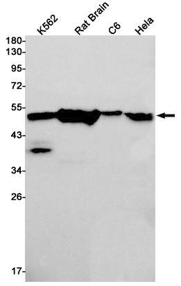 Tubulin Beta 4 Antibody (SR2377)