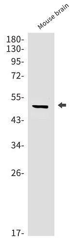 Tubulin Beta 4 Antibody (SR2377)