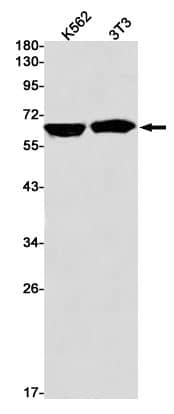 IGF2BP1 Antibody (SR2428)