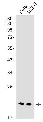 UBE2F/NCE2 Antibody (SR2446)