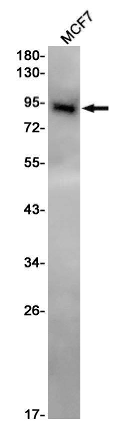 PIP5K1C Antibody (SR2466)