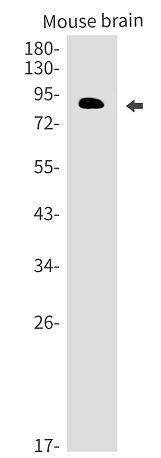 PIP5K1C Antibody (SR2466)