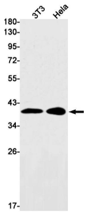 UCH-L5/UCH37 Antibody (SR2509)