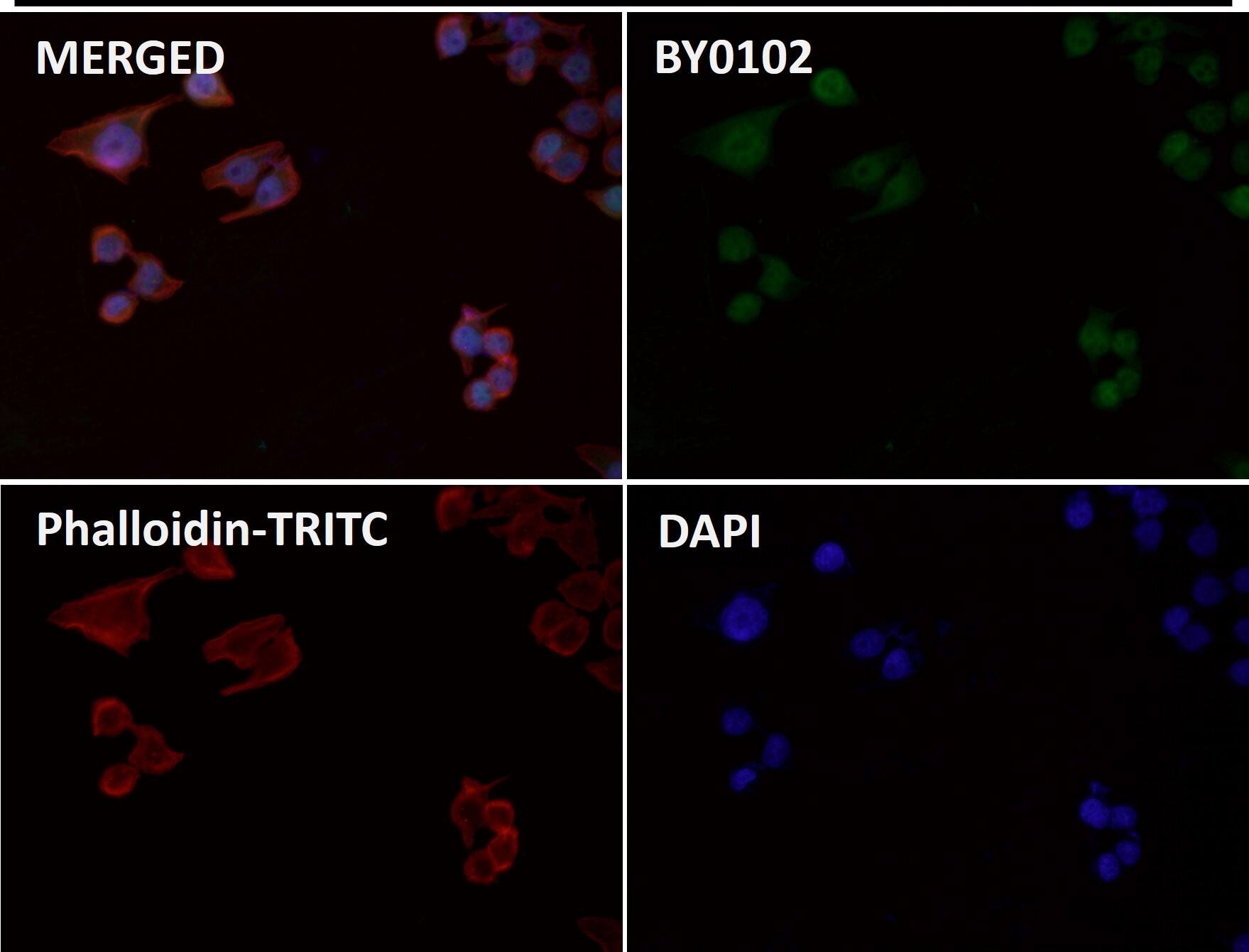 CCDC109A [p Ser92] Antibody (SR2322) - BSA Free