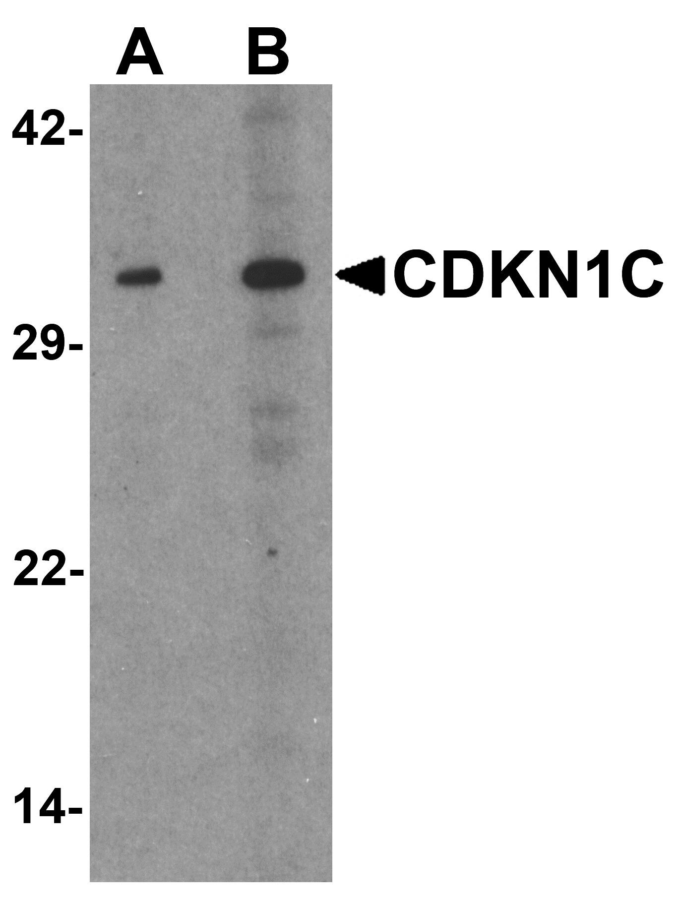 p57 Kip2 Antibody