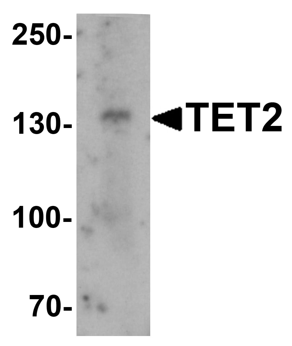 TET2 Antibody