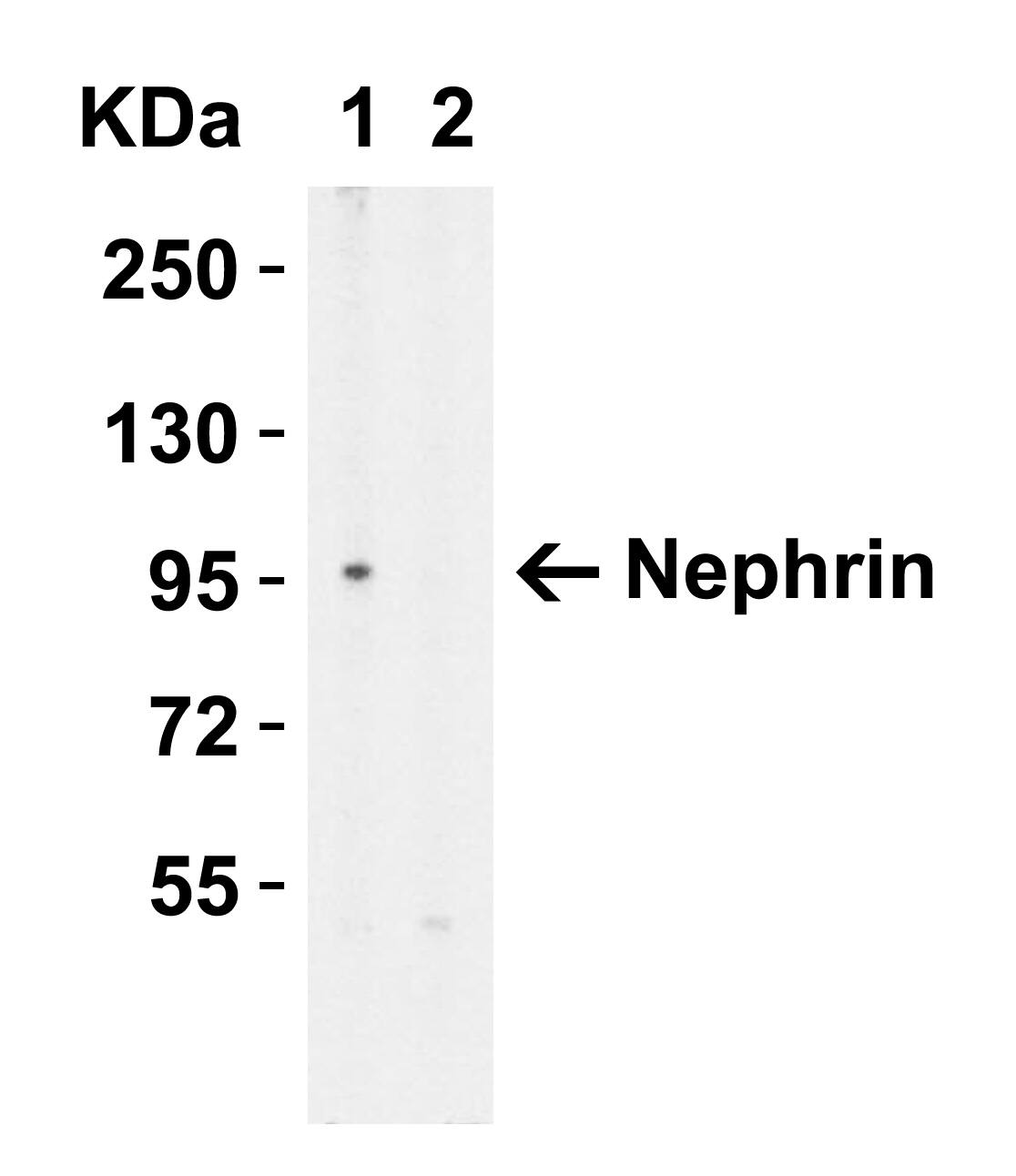 Myosin VIIb Antibody