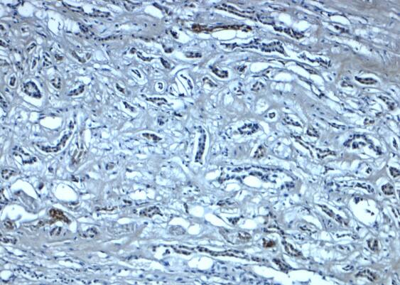 Myosin VIIb Antibody