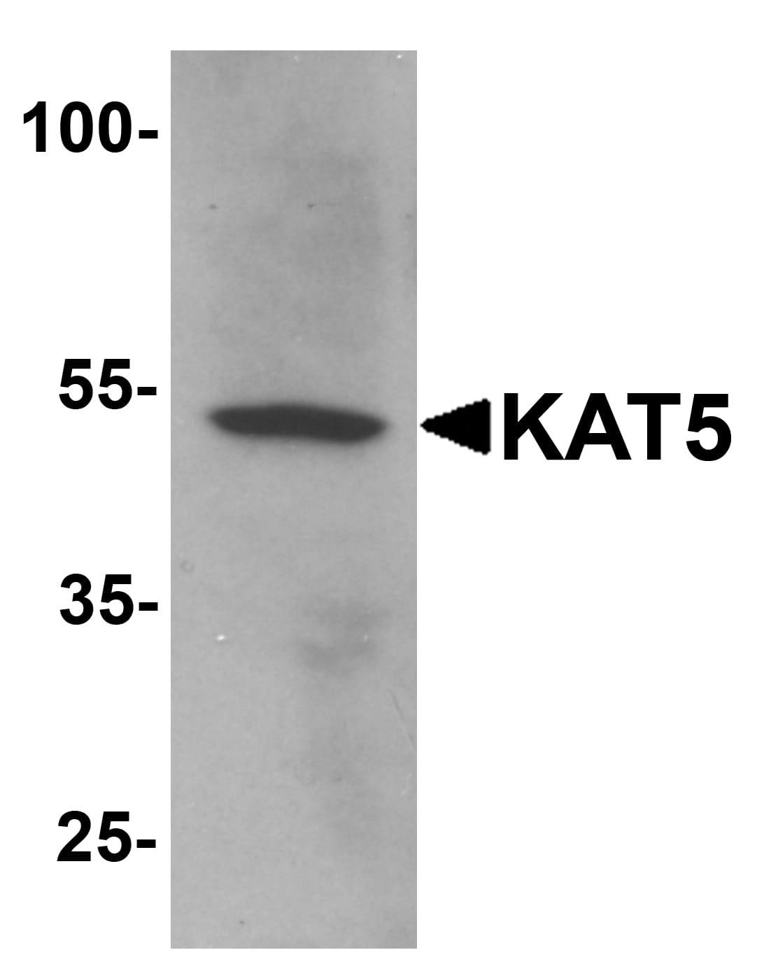 TIP60 Antibody