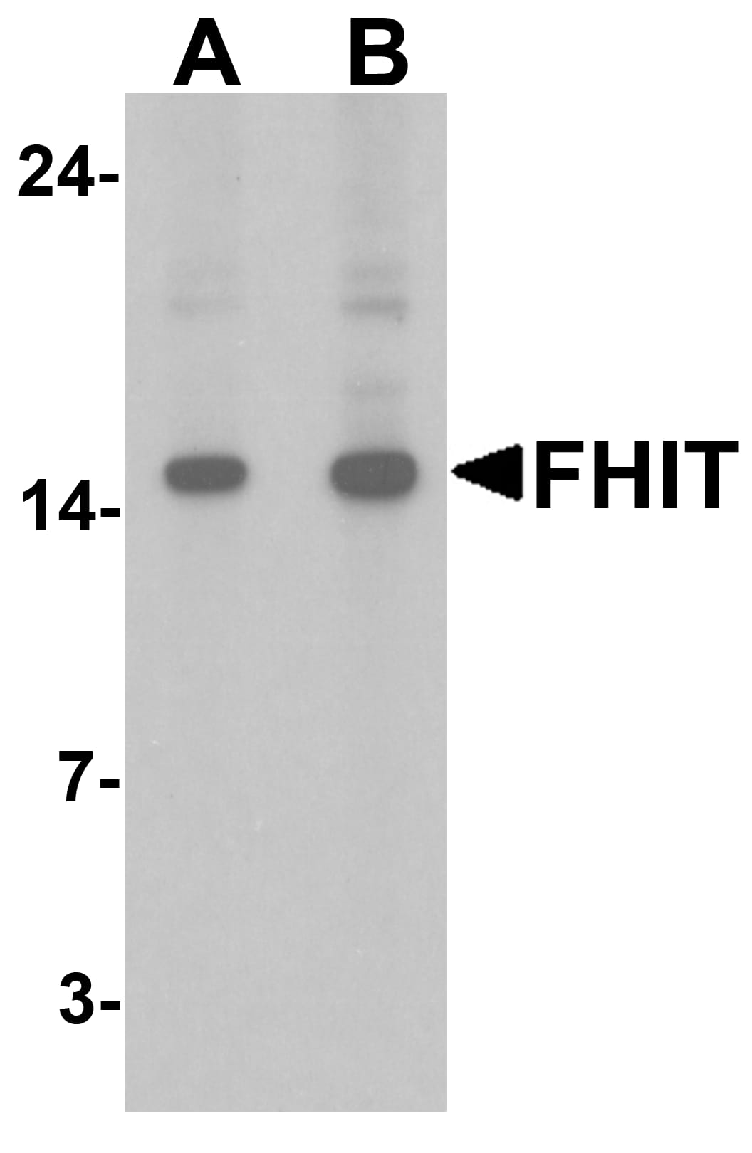 FHIT Antibody