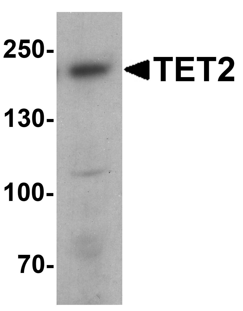 TET2 Antibody