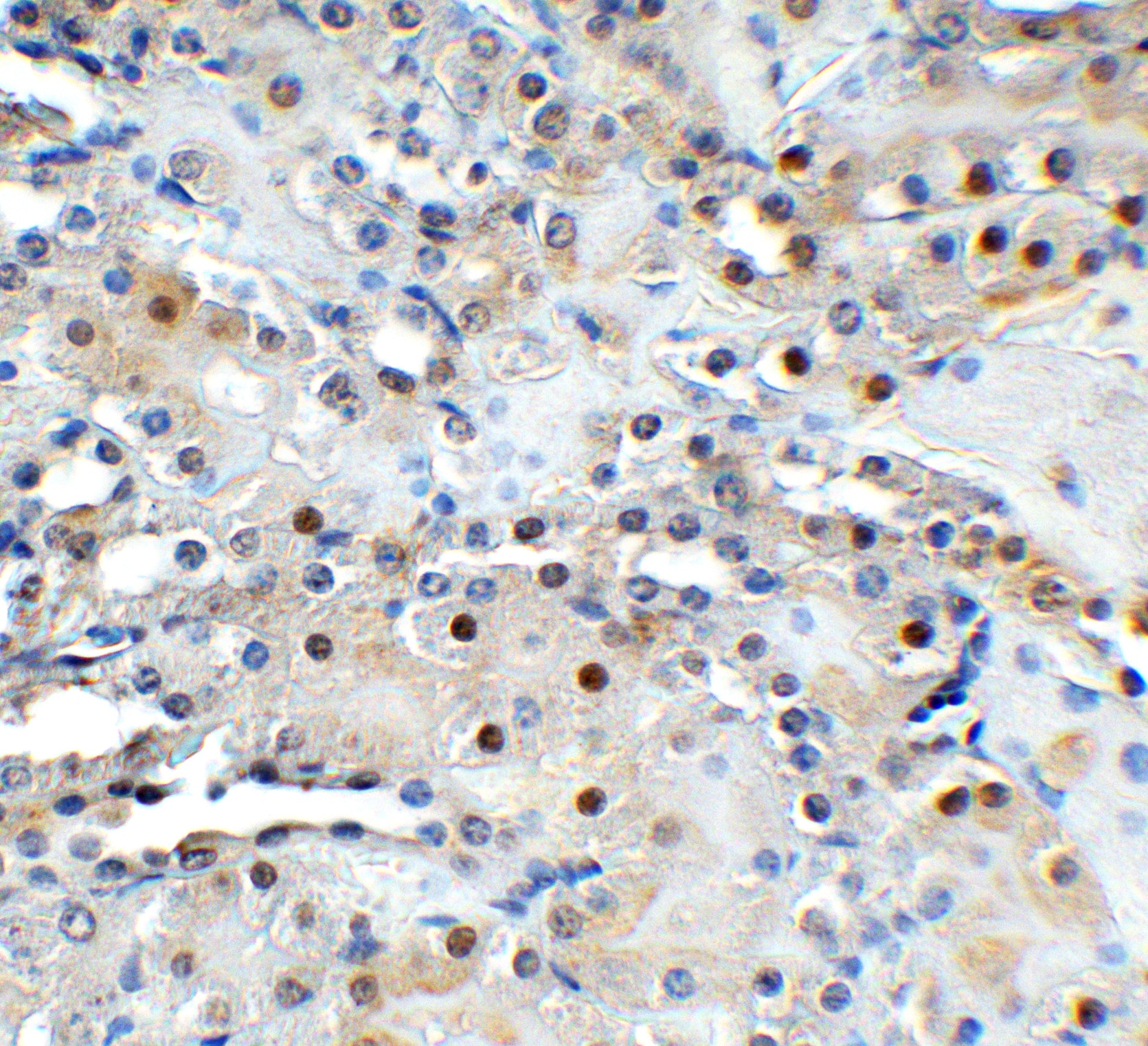 TET1 Antibody